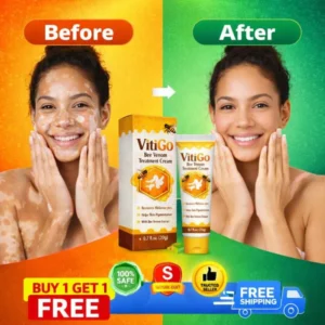 md vitigo advanced treatment for white patches