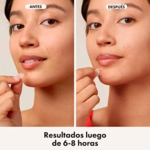 mighty patch original for whiteheads and spots