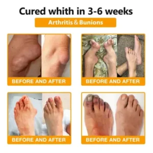 bee venom plus natural joint support