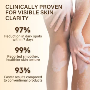 viticlear bee venom cream before and after white spots