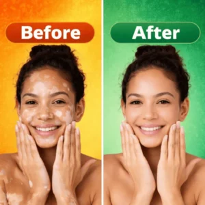 natural skin restoration cream md vitigo