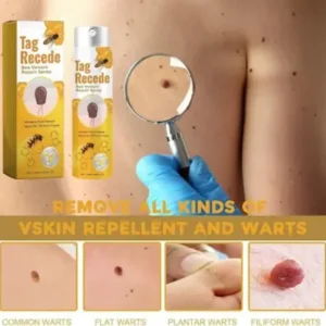 natural skin tag care solution lovilds
