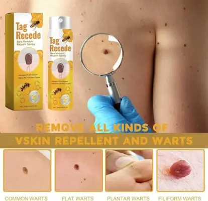 natural skin tag care solution lovilds