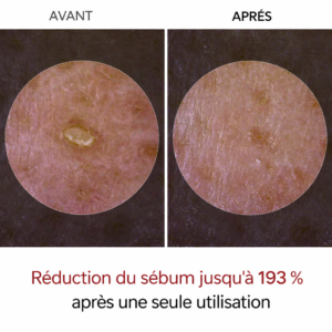 purepore visible results skincare