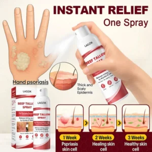 laozik beef tallow spray for itchy skin relief