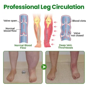 laozik venosoothe leg relief spray for varicose veins