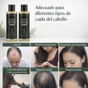 dexvon professional scalp revitalizing formula