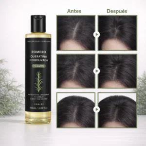 dexvon shampoo for reducing hair thinning