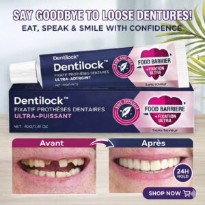 dentilock ultra strong denture adhesive for all-day hold