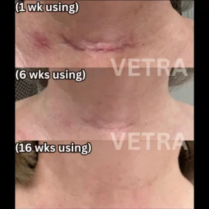 best stick for boosting natural skin healing