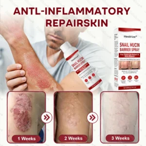 best barrier spray for repairing damaged skin fast