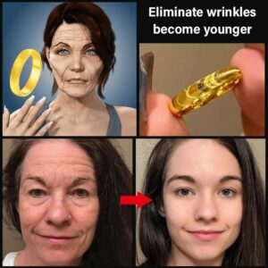 safe and non-invasive detox ring with official store