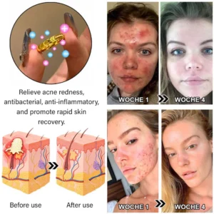 best ring for boosting metabolism and circulation