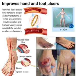 soothing finger tension with cat eye therapy ring