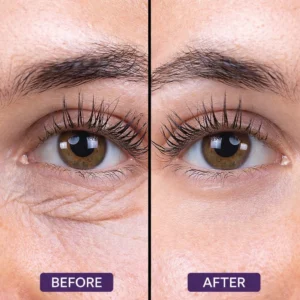 advanced biocollagen technology by eye care brand