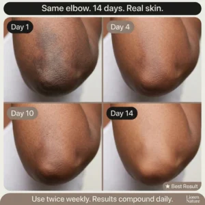 advanced dark circle technology by skincare brand