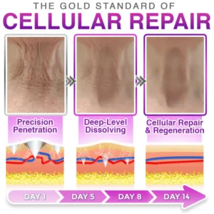 carebreeze patch before and after deep wrinkle filling