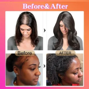 how to apply botanix batana oil for thinning hair