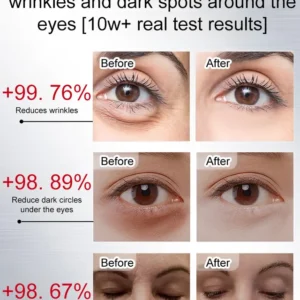 lumiessence cream before and after wrinkle smoothing