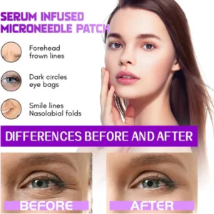 lunnexi professional grade glowlift patches reviews