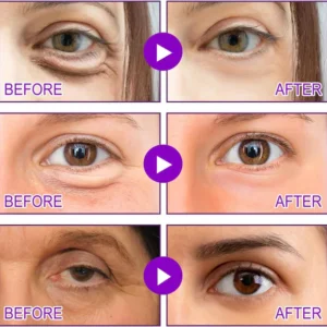 how to apply lunnexi eye patches for de-puffing