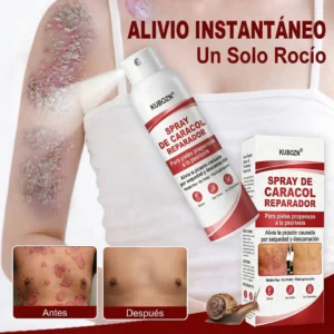 Best effective spray for dry plaques and scaly skin CADACOL