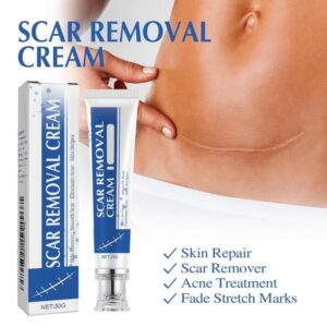 Advanced stretch marks removal cream for pregnancy and weight loss