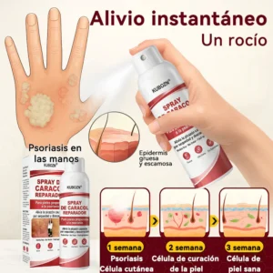 CADACOL Repair Spray for psoriasis skin and redness relief