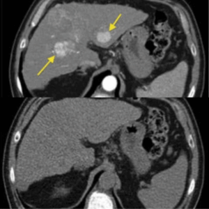 Elycura™ Prostate Health Supplement for natural urinary support