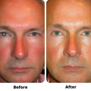 Natural lubricating eye serum for clear vision by TIMILK