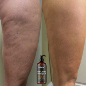 Applying Veluvia anti-cellulite oil on legs