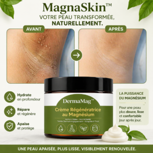 MagnaSkin Magnesium Cream before and after results on leg cramps
