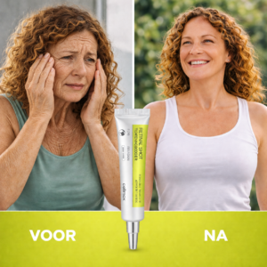 Intensive wrinkle repair ointment by Dermalift for aging skin