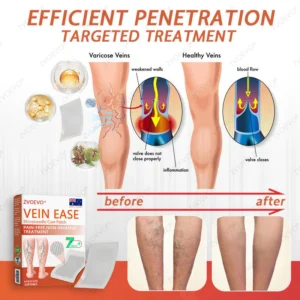 Best effective microneedle patch for improving venous circulation Zvoevo