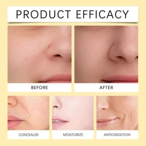 Best effective nighttime treatment for hyperpigmentation Medicube