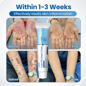 Natural buttock enlargement cream by Ceoerty CurvLift