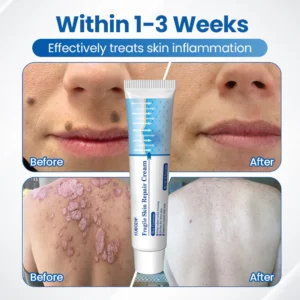 Ceoerty CurvLift cream before and after body contour results