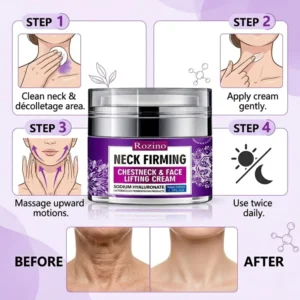 Rozino Neck Cream before and after results on turkey neck