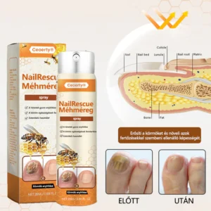 Ceoerty® Nail Detox Penetration Serum Pen for fungus treatment