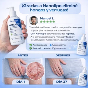 Painless genital wart and lump removal solution Oveallgo