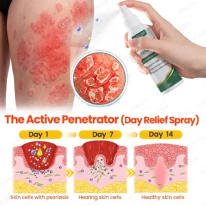 Best steroid-free treatment for dry scaling and itchy skin