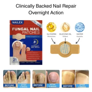 Applying Nailex fungal nail patch to damaged toenail