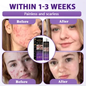 Evolvion® Biotin Spray before and after results on skin texture