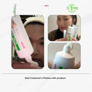 Swissvita Acne Cleanser before and after results on blemish redness