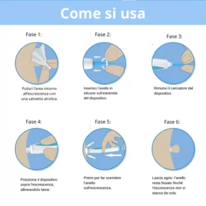 Dermaclear™ before and after results on skin fibroid removal