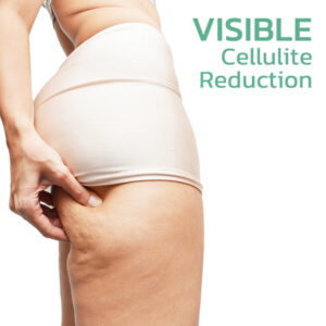 Hydrating collagen body oil by flysmus BewtyMax for sagging skin