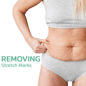 flysmus BewtyMax Collagen Oil before and after body lifting results