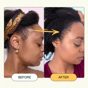 Applying Vitra Batana oil to scalp for strengthening