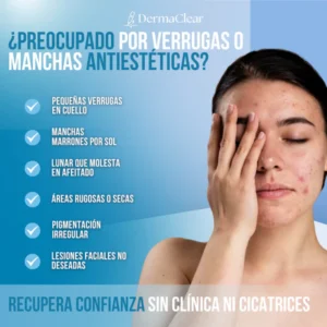 Instant skin perfecting serum by Dermaclear for blemish control