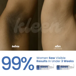 Kleen Cheeks™ Brightening Lotion premium 100ml pump bottle